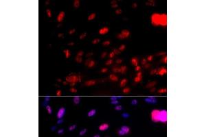 Immunofluorescence analysis of U2OS cells using Phospho-CHEK1(S317) Polyclonal Antibody