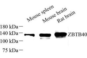 Western blot analysis of ZBTB40 (ABIN7076250) at dilution of 1: 250