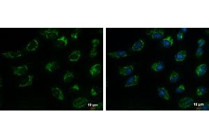 ICC/IF Image TIM17 antibody detects TIM17 protein at mitochondria by immunofluorescent analysis. (TIMM17A antibody  (C-Term))