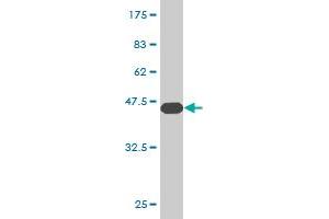 Western Blot detection against Immunogen (43. (CGB5 antibody  (AA 1-165))