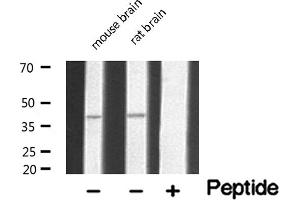 Western blot analysis of extracts of various tissue sample,using 5-HT-5A Antibody . (Serotonin Receptor 5A antibody  (Internal Region))