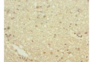Immunohistochemistry of paraffin-embedded human brain tissue using ABIN7154932 at dilution of 1:100 (HHIP antibody  (AA 18-220))