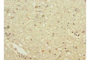 Immunohistochemistry of paraffin-embedded human brain tissue using ABIN7154932 at dilution of 1:100