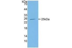 Detection of Recombinant CBFb, Human using Polyclonal Antibody to Core Binding Factor Beta Subunit (CBFb) (CBFB antibody  (AA 1-182))