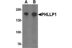Western blot analysis of PHLPP1 in SW480 cell lysate with PHLPP1 Antibody  at (A) 1 and (B) 2 μg/ml.