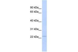 Image no. 1 for anti-Proteasome Subunit beta 3 (PSMB3) (AA 71-120) antibody (ABIN6741388) (PSMB3 antibody  (AA 71-120))