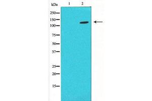 Western blot analysis on LOVO using HIF1a antibody ,The lane on the left is blocked with the antigen-specific peptide. (HIF1A antibody  (Internal Region))