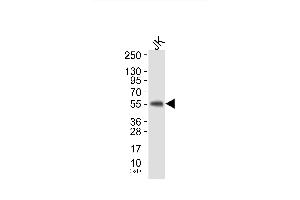 Western blot analysis of extracts from JK cells, using HS1 (Ab-397) Antibody.