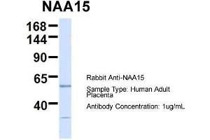 Host:  Rabbit  Target Name:  NAA15  Sample Type:  Human Adult Placenta  Antibody Dilution:  1. (NAA15 antibody  (N-Term))