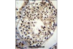 Immunohistochemistry (Paraffin-embedded Sections) (IHC (p)) image for anti-AlkB, Alkylation Repair Homolog 6 (ALKBH6) (AA 116-145) antibody (ABIN655230)