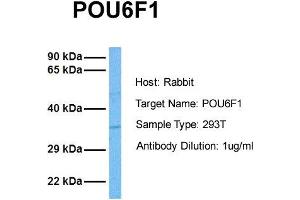 Host: Rabbit Target Name: POU6F1 Sample Tissue: Human 293T Antibody Dilution: 1. (POU6F1 antibody  (Middle Region))