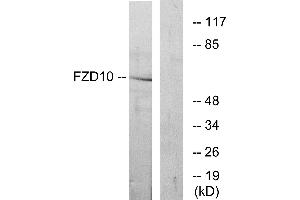 Western blot analysis of extracts from COS-7 cells, using FZD10 antibody. (FZD10 antibody  (Internal Region))