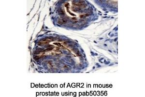Image no. 1 for anti-Anterior Gradient Homolog 2 (Xenopus Laevis) (AGR2) (AA 1-50), (N-Term) antibody (ABIN363665)