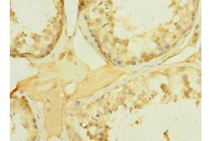 Immunohistochemistry of paraffin-embedded human testis tissue using ABIN7166559 at dilution of 1:100 (PCDH15 antibody  (AA 160-400))