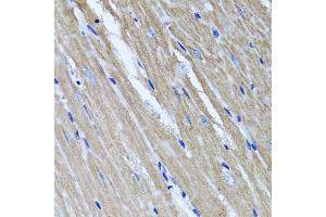 Immunohistochemistry of paraffin-embedded mouse heart using TNFAIP6 antibody (ABIN5975410) at dilution of 1/100 (40x lens). (TNFAIP6 antibody)