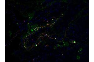 Co-expression of SARS-CoV-2 (COVID-19) Envelope and C5b-9 in Human Lung Tissue from the COVID-19 Patient: Immunofluorescent l analysis of paraffin-embedded COVID-19 patient lung tissue using anti- SARS-CoV-2 (COVID-19) Envelope antibody (ABIN1031551, 2 μg/mL, red) and anti-C5b-9 antibody (green). (SARS-CoV-2 Envelope antibody  (N-Term))