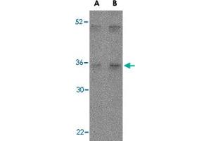 Western blot analysis of IL27 in Daudi lysate with IL27 polyclonal antibody  at (A) 2 and (B) 4 ug/mL . (IL-27 antibody  (Internal Region))
