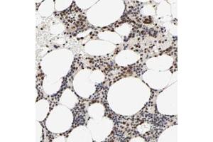 Immunohistochemical staining (Formalin-fixed paraffin-embedded sections) of human bone marrow with ZNF192 polyclonal antibody  shows strong nuclear positivity in bone marrow poietic cells.
