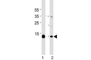 Western blot analysis of lysate from mouse 1) heart and 2) skeletal muscle tissue lysate using Myoglobin antibody at 1:1000 for each lane. (Myoglobin antibody  (C-Term))