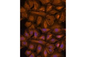 Immunofluorescence analysis of U-2 OS cells using STUB1 Polyclonal Antibody (ABIN6129459, ABIN6148649, ABIN6148650 and ABIN6215447) at dilution of 1:100 (40x lens). (STUB1 antibody  (AA 1-303))