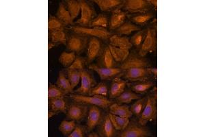 Immunofluorescence analysis of U-2 OS cells using STUB1 Polyclonal Antibody (ABIN6129459, ABIN6148649, ABIN6148650 and ABIN6215447) at dilution of 1:100 (40x lens). (STUB1 antibody  (AA 1-303))