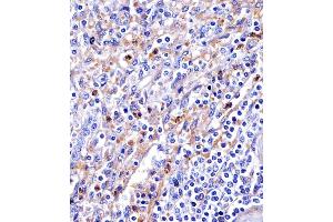 (ABIN6244292 and ABIN6578679) staining Transferrin in human spleen tissue sections by Immunohistochemistry (IHC-P - paraformaldehyde-fixed, paraffin-embedded sections). (Transferrin antibody  (AA 432-466))