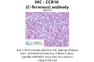 Image no. 1 for anti-Chemokine (C-C Motif) Receptor 10 (CCR10) (C-Term) antibody (ABIN1732759) (CCR10 antibody  (C-Term))