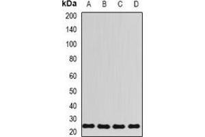 Western blot analysis of RPL13 expression in HT29 (A), Hela (B), mouse spleen (C), rat lung (D) whole cell lysates. (RPL13 antibody)