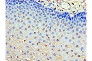 Immunohistochemistry of paraffin-embedded human esophagus tissue using ABIN7154506 at dilution of 1:100 (GRB7 antibody  (AA 233-532))