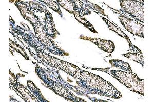 IHC analysis of Claudin18/CLDN18 using anti-Claudin18/CLDN18 antibody (ABIN7601257). (Claudin 18 antibody  (AA 31-261))