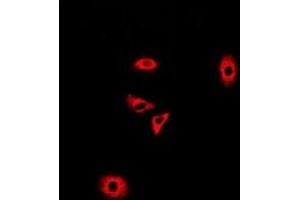 Immunofluorescent analysis of GLUD2 staining in A549 cells. (GLUD2 antibody)
