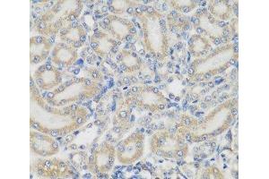 Immunohistochemistry of paraffin-embedded Rat kidney using PYCR1 Polyclonal Antibody at dilution of 1:200 (40x lens).