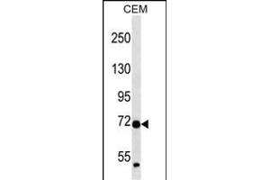 ZN Antibody (N-term ) (ABIN657252 and ABIN2837915) western blot analysis in CEM cell line lysates (35 μg/lane). (ZNF443 antibody  (N-Term))