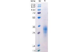 SDS-PAGE (SDS) image for B and T Lymphocyte Associated (BTLA) (AA 31-150) protein (His tag) (ABIN7092696)
