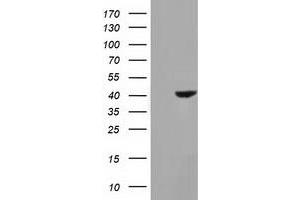 Western Blotting (WB) image for anti-Hydroxyacid Oxidase (Glycolate Oxidase) 1 (HAO1) antibody (ABIN1498576)