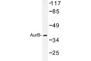 Image no. 1 for anti-Aurora Kinase B (AURKB) antibody (ABIN272108) (Aurora Kinase B antibody)