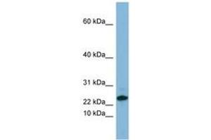 Image no. 1 for anti-Small Proline-Rich Protein 3 (SPRR3) (C-Term) antibody (ABIN6741688) (SPRR3 antibody  (C-Term))