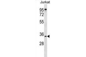 Western Blotting (WB) image for anti-UBX Domain Protein 8 (UBXN8) antibody (ABIN2998959) (UBXN8 antibody)
