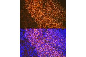 Immunofluorescence (IF) image for anti-CD79b Molecule, Immunoglobulin-Associated beta (CD79B) antibody (ABIN1682474)