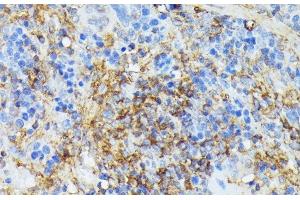 Immunohistochemistry of paraffin-embedded Rat spleen using COX15 Polyclonal Antibody at dilution of 1:100 (40x lens). (COX15 antibody)