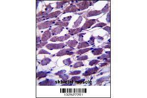 MYOM1 Antibody immunohistochemistry analysis in formalin fixed and paraffin embedded human skeletal muscle followed by peroxidase conjugation of the secondary antibody and DAB staining. (Myomesin 1 antibody  (AA 904-933))