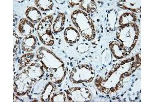 Immunohistochemical staining of paraffin-embedded Kidney tissue using anti-PLEK mouse monoclonal antibody.