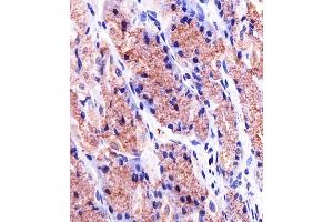 Immunohistochemical analysis of paraffin-embedded H. (Prohibitin antibody  (AA 1-205))