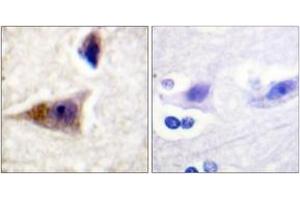 Immunohistochemistry (IHC) image for anti-Caspase 1 (CASP1) (AA 342-391), (pSer376) antibody (ABIN1531644)