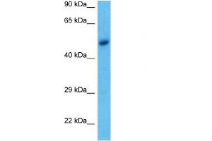 WB Suggested Anti-ACHA9 antibody Titration: 1 ug/mL Sample Type: Human MCF7 Whole Cell (CHRNA9 antibody  (N-Term))