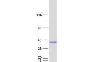 Validation with Western Blot (SNX11 Protein (Transcript Variant 1) (Myc-DYKDDDDK Tag))