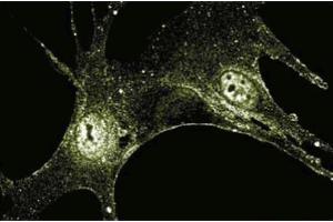 Immnuofluroescence staining of human fibroblasts. (FGF2 antibody  (AA 1-155))