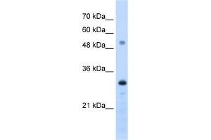 WB Suggested Anti-PSME3 Antibody Titration:  1. (PSME3 antibody  (C-Term))