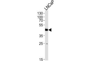 Western Blotting (WB) image for anti-Family with Sequence Similarity 54, Member A (FAM54A) antibody (ABIN3004761) (FAM54A antibody)