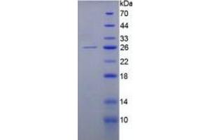 SDS-PAGE of Protein Standard from the Kit  (Highly purified E. (KRT8 ELISA Kit)
